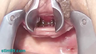 Masturbate Peehole with Curry and Chain into Urethra